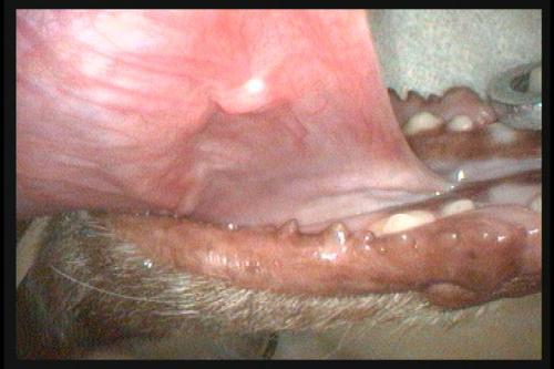 One of the mouth ulcers